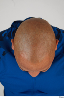 Photos Ernesto Lacasa bald head 0006.jpg